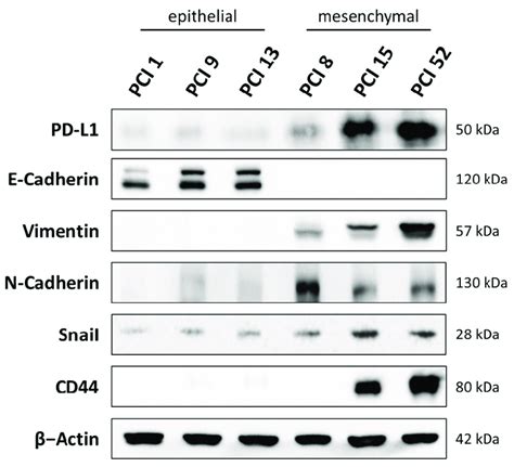 Characterization Of Hnscc Cell Lines The Basal Expression Of Pd L