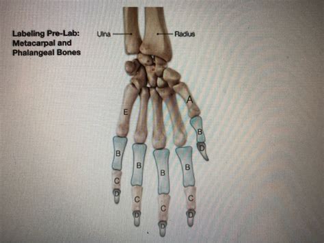 Solved Ulna Radius Labeling Pre Lab Metacarpal And