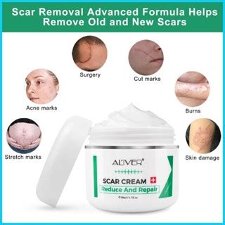 ALIVER Old Scar Remover For Legs 50ml Scar Repair Cream Remove Acne