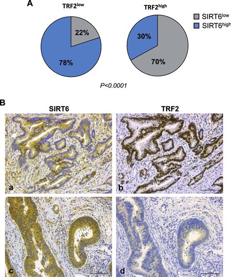 Inverse Correlation Between Trf2 And Sirt6 Immunohistochemical