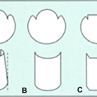 Varieties Of Pincer Nail A Pincer Or Trumpet Type B Tile Shaped