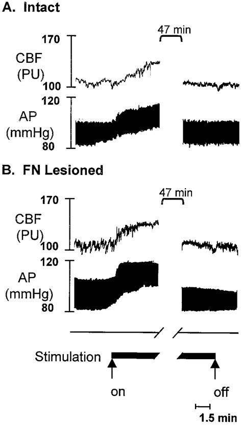 Changes In Ap And Rcbf In Anesthetized Rats Elicited By Electrical