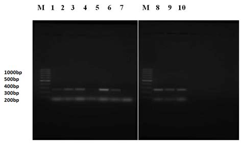 Serogrouping Of H Influenzae Strains Subjected To Multiplex PCR With