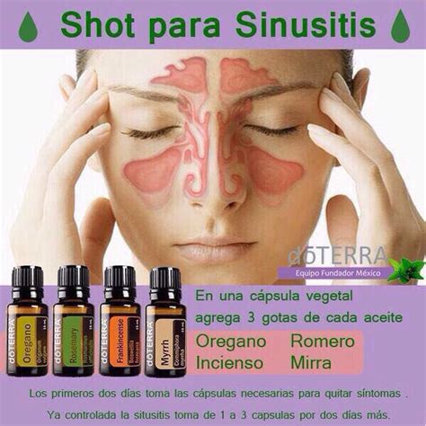 Sinusitis Recetas De Aceites Esenciales Doterra Aceite Romero