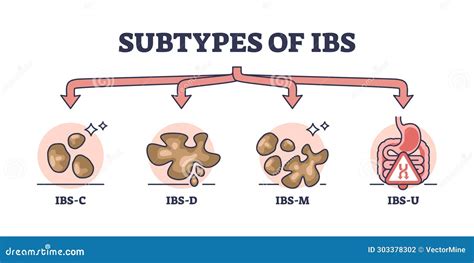 Subtypes Of Ibs Or Irritable Bower Syndrome Classification Outline