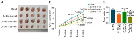 Rnabinding Protein Quaking Inhibits The Progression Of Nonsmall