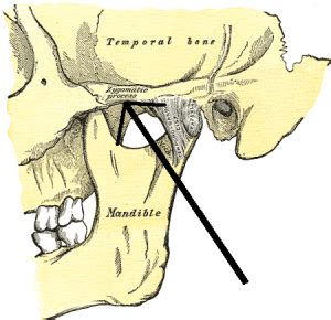 Zygomatic arch fracture - WikEM