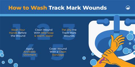 Track Marks: What They Look Like & How to Recover