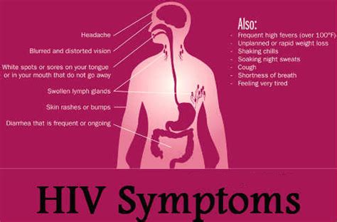 COMMON SYMPTOMS OF HIV/AIDS