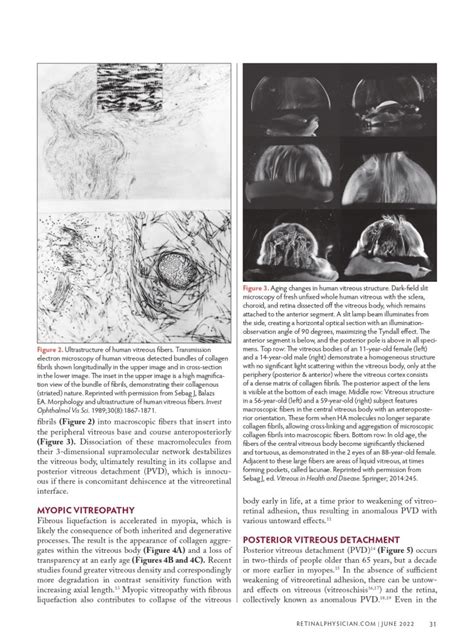 Recent Publication On Vdm Part Of Etiology And Diagnosis Of