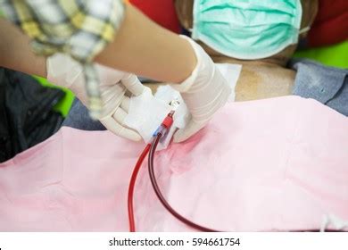 Dialysis catheter 로열티 프리 이미지 스톡 사진 Shutterstock