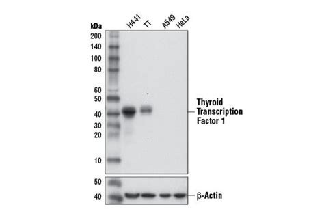 Thyroid Transcription Factor 1 TTF 1 D2E8 Rabbit MAb Cell