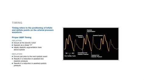 Iabp Troubleshooting Ppt