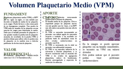 Volumen Plaquetario Medio Pdf Plaqueta Sangre