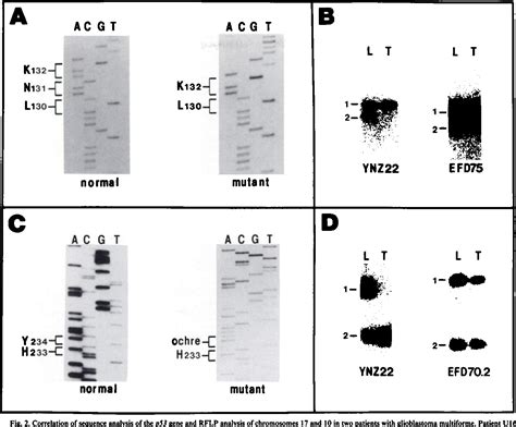 Table 1 From P53 Mutation And Loss Of Heterozygosity On Chromosomes 17 And 10 During Human