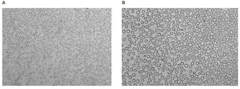 Hematopoietic Stem Cell Culture Methods