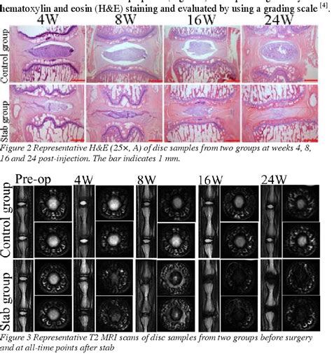 Figure From The Relationship Between Mri And Histology In A Rat Model