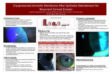 Pdf Cryopreserved Amniotic Membrane After Epithelial Debridement For