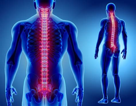 Penyebab Spinal Stenosis Yang Mesti Anda Waspadai KlikDokter