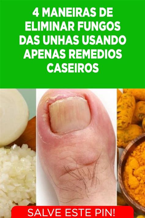 4 maneiras de eliminar fungos das unhas usando apenas remédios caseiros