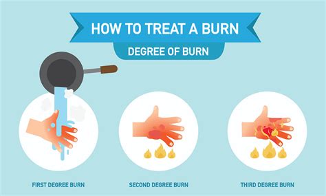 First Degree Burn First Aid