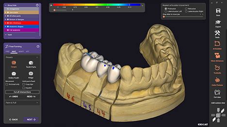 Dentalcad Galway Exocad