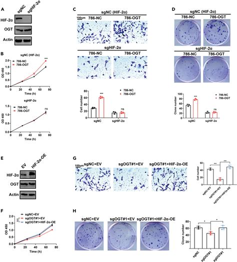 OGT HIF 2α axis promotes the progression of clear cell renal cell