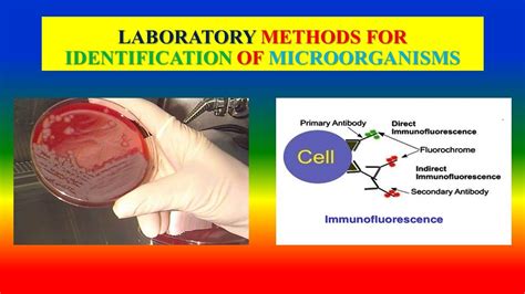 Laboratory Methods For Identification Of Microorganisms Youtube