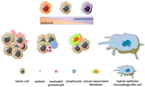 Cancers Free Full Text Signatures Of Breast Cancer Progression In