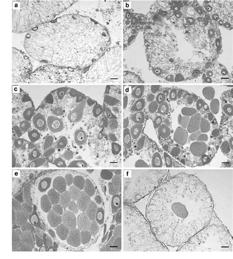 Photomicrographs Of Females Gonadal Stages Of L Albus A Immature B