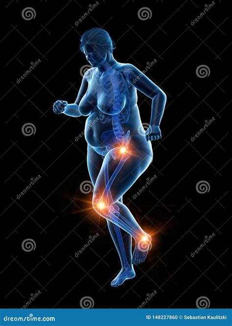 An Overweight Womans Painful Knees Royalty-Free Illustration