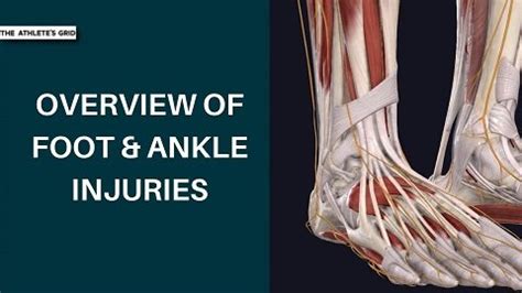 Overview of Foot and Ankle Injuries | The Athlete’s Grid: Recovery Vault