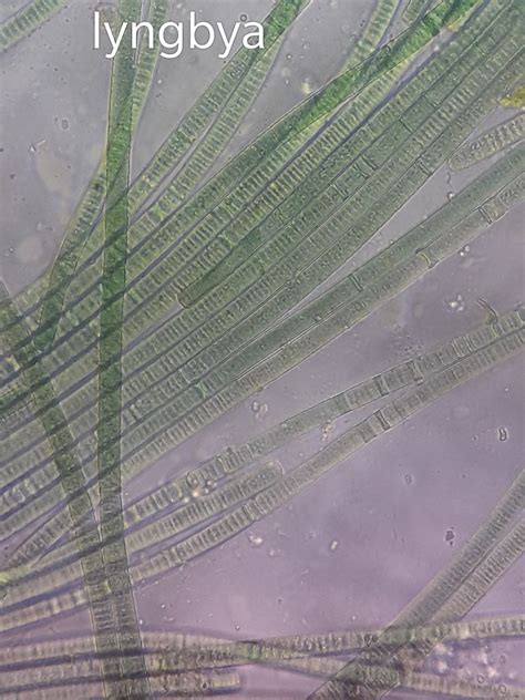 Help me to identify these algae? | ResearchGate