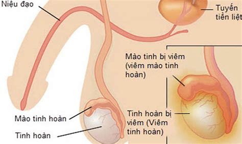 Suy Giảm Testosterone ở Nam Giới Nguyên Nhân Và Cách Nhận Biết Kiến Thức Giới Tính Việt