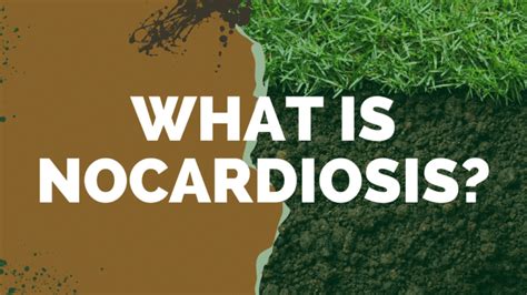 What is Nocardiosis? - Walkin Lab