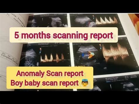 Months Scan Anomaly Scan Boy Baby Scan Report Baby Scan