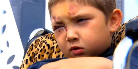 6 Year Old Beaten After Standing Up To Bullies Fox News Video