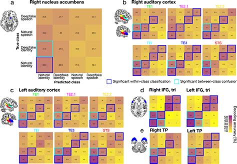 News Jülich Brain Atlas