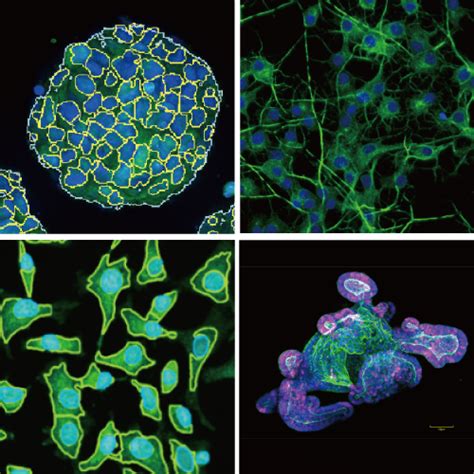 CQ1 Benchtop High Content Analysis System Confocal High Content Imaging