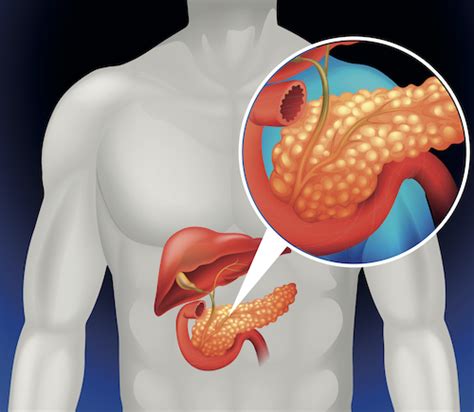 Hepato Pancreato Biliary Surgery And The Pancreas In Nashville