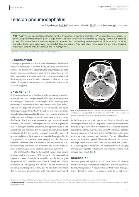 (PDF) Tension pneumocephalus