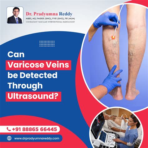 Vascular Ultrasound Of Legs