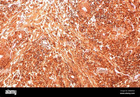 smooth muscle actin light micrograph stock photo alamy