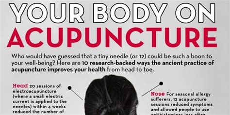 10 Pretty Fantastic Reasons To Try Acupuncture