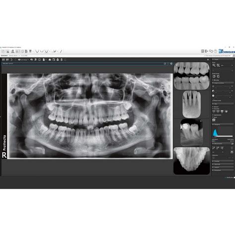 VisionX Imaging Software - Air Techniques