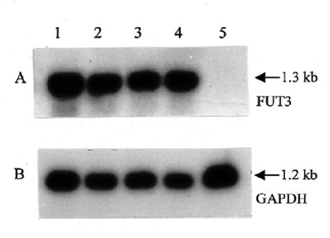 Northern Blot Analysis Of Total Rna G Lane From Cos Cells