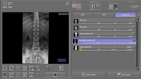 Dx R X Ray Acquisition Software Calico Medical Incorporated