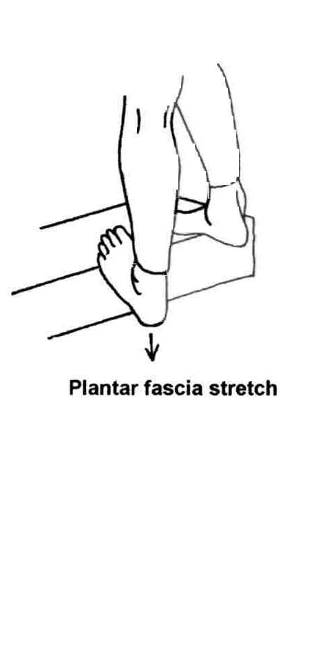 Plantar Fasciitis 321gomd