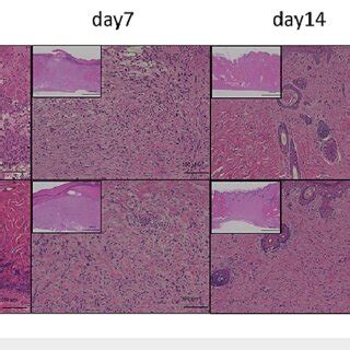 H E Histological Observation Of Wounds In Both Groups On 3 7 14 And