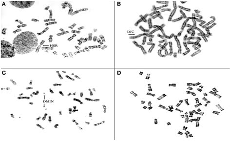 Representative Metaphase Spreads Obtained From Four Different